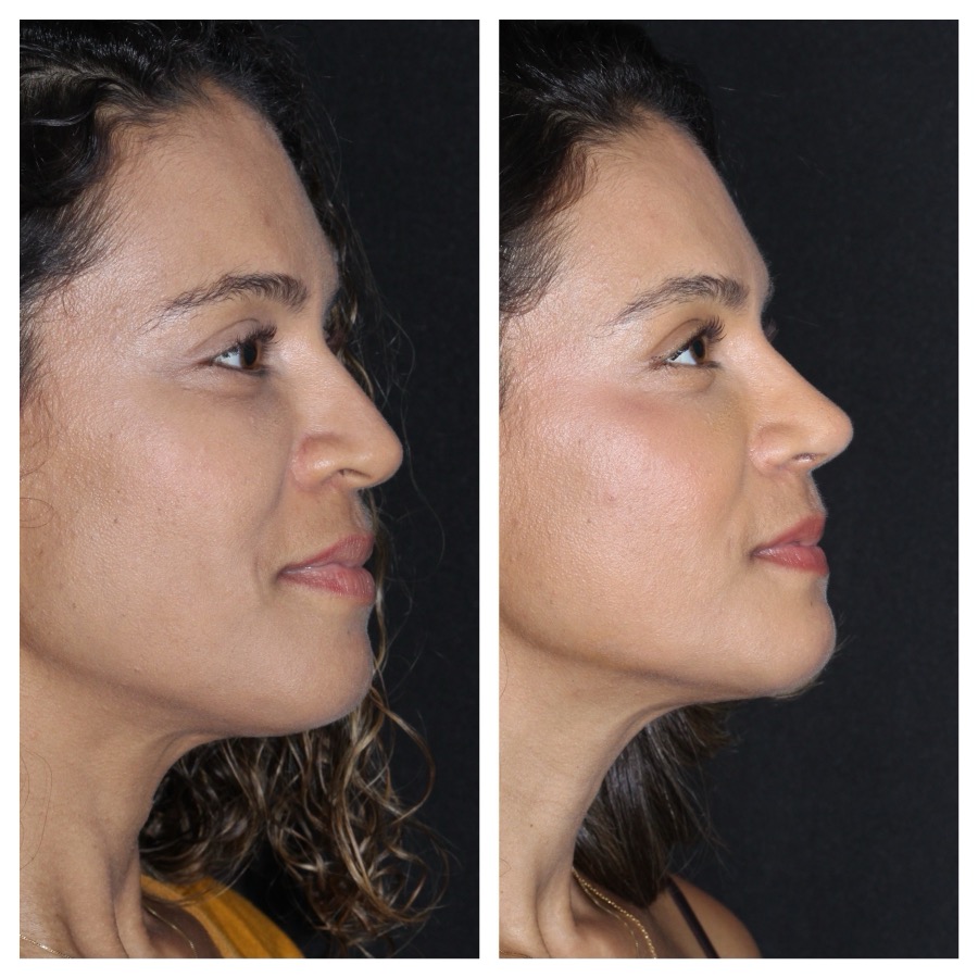 Caso 01: antes e depois