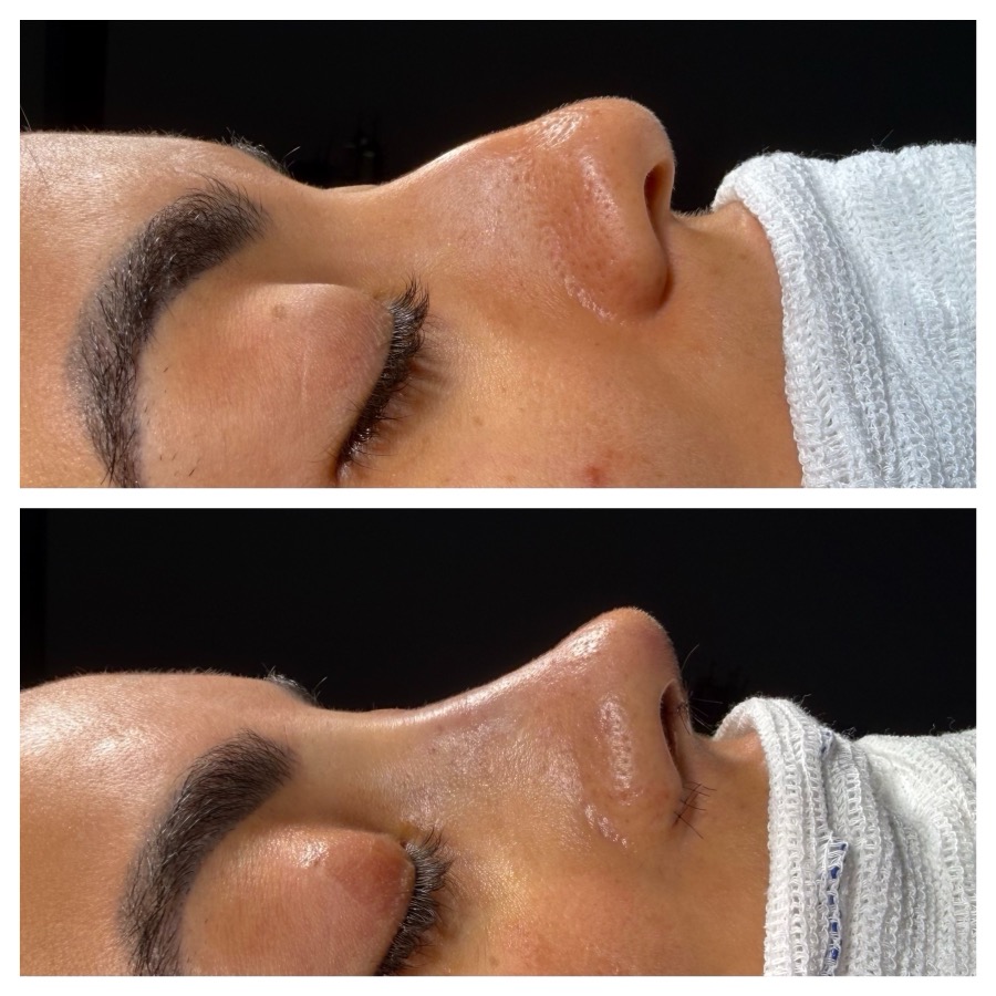 Caso 02: antes e depois