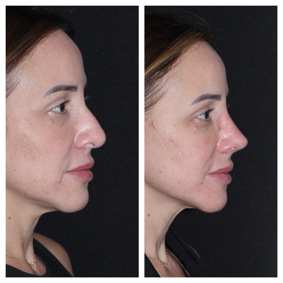 Caso 03: antes e depois