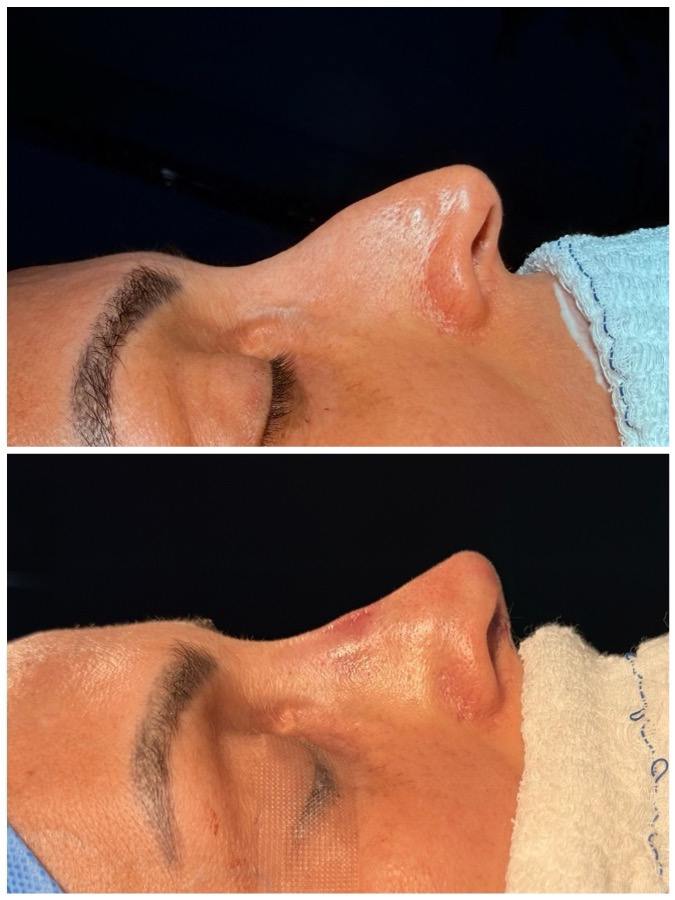 Caso 05: antes e depois