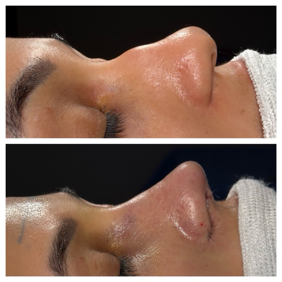 Caso 06: antes e depois