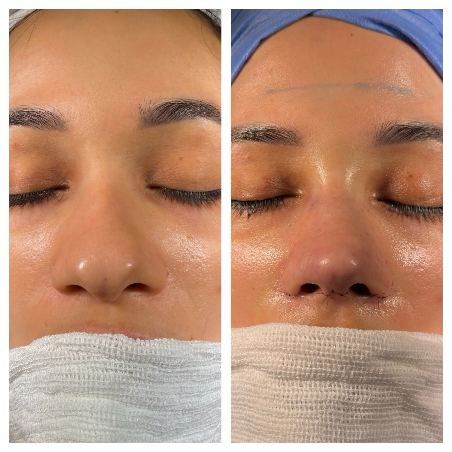 Caso 07: antes e depois