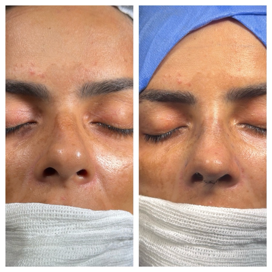 Caso 08: antes e depois