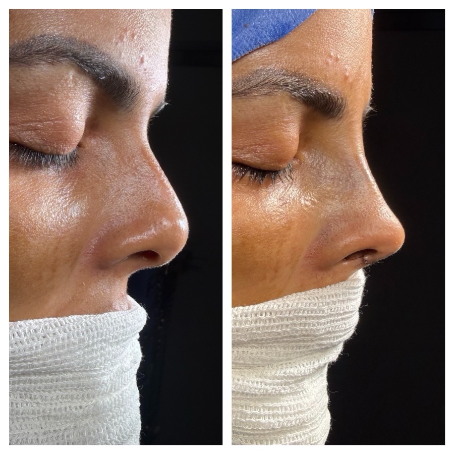 Caso 09: antes e depois